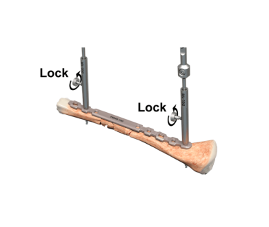 Drill guide with lock