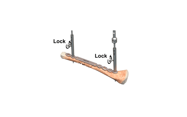 Drill guide with lock