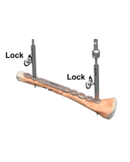 Drill guide with lock